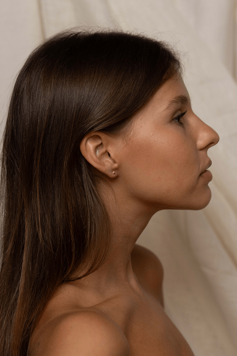 MKT_EMC_0012_DOURADO-2